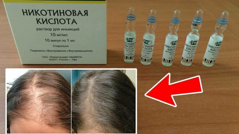 Никотиновая кислота для роста волос